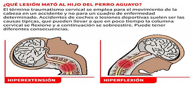 ¿Qué lesión mató al hijo del Perro Aguayo?